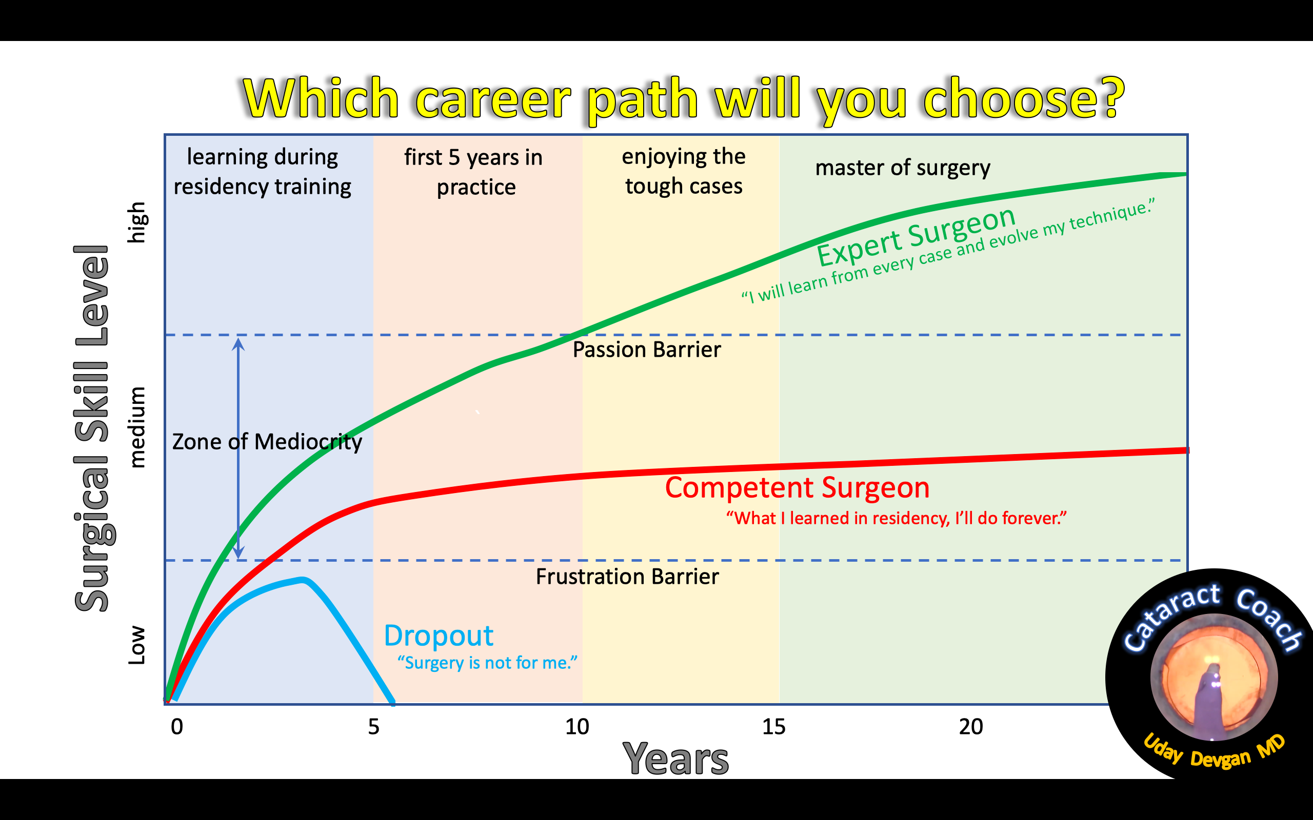 learning curve over the career of an ophthalmologist for cataract surgery